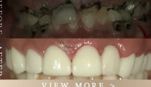 池袋シンプル歯科